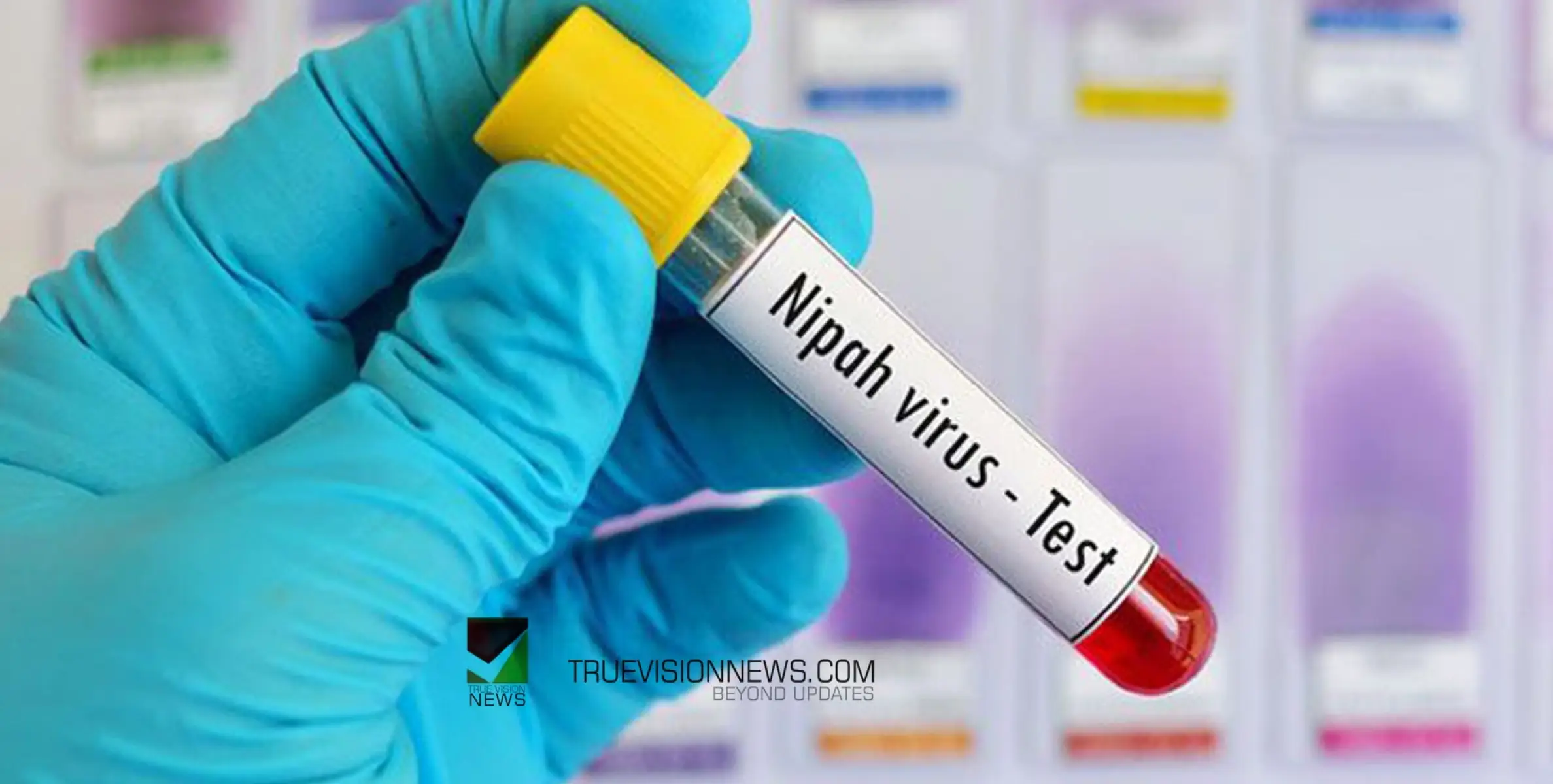 #nipah | നിപ രോഗലക്ഷണങ്ങളുമായി കേരളത്തിൽ നിന്ന് മടങ്ങിയെത്തിയ തൊഴിലാളിയുടെ പരിശോധനാ ഫലം നെഗറ്റീവ്