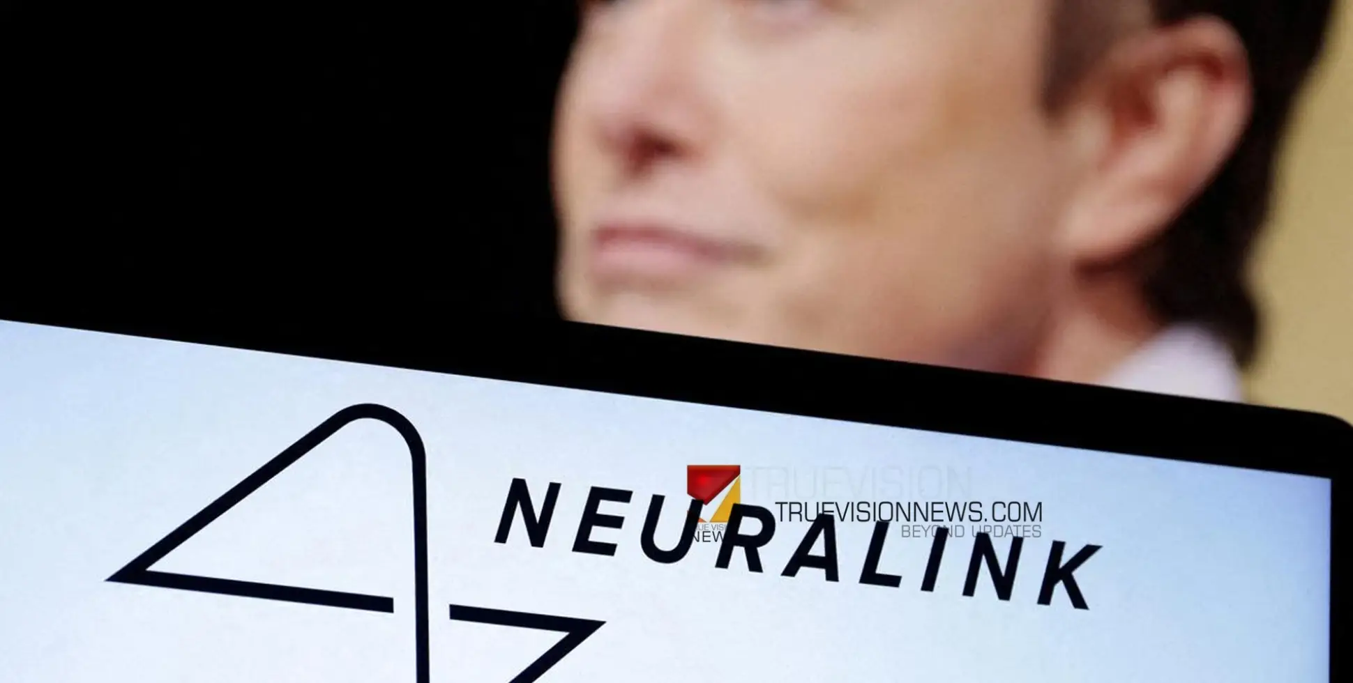 #Neuralink | മസ്കിന്റെ ന്യൂറാലിങ്ക് ചിപ്പ് ആദ്യമായി മനുഷ്യരില്‍ പരീക്ഷിക്കുന്നു; ക്ലിനിക്കൽ ട്രയലിനായി എഫ്‌ഡിഎയുടെ അംഗീകാരം ലഭിച്ചതായി കമ്പനി